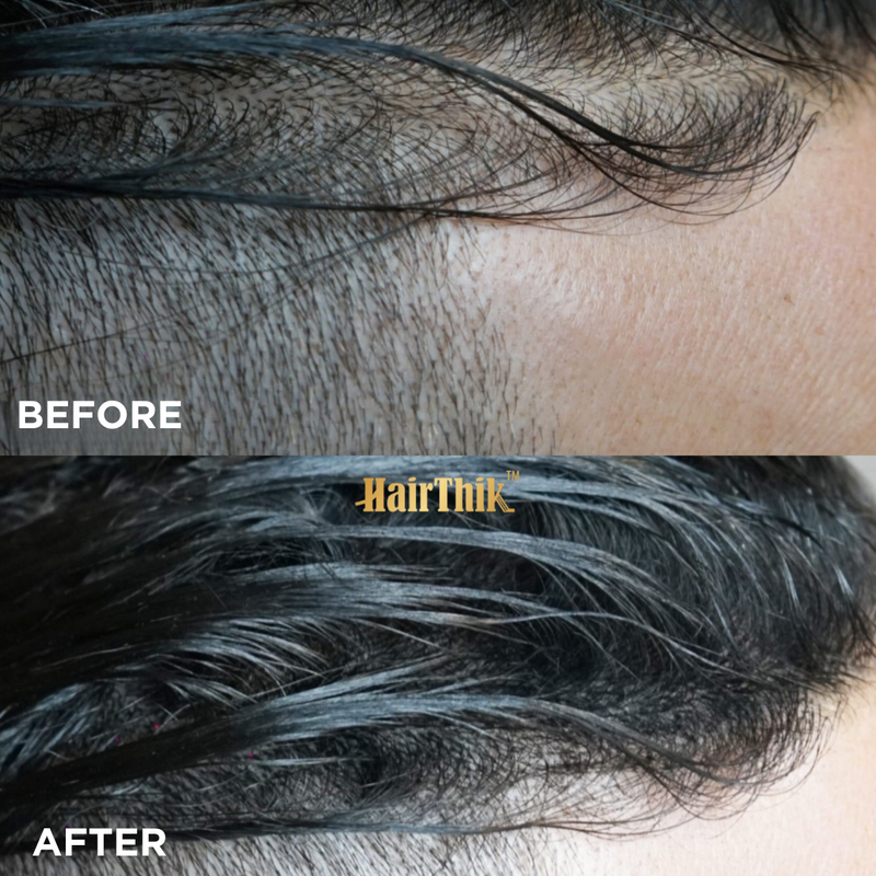Supreme Trimmer HairThik Hair Fiber Kit